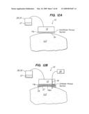 Tissue surface treatment apparatus and method diagram and image