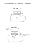 Tissue surface treatment apparatus and method diagram and image