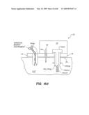 Tissue surface treatment apparatus and method diagram and image