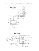 Tissue surface treatment apparatus and method diagram and image