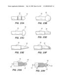 Tissue surface treatment apparatus and method diagram and image