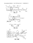 Tissue surface treatment apparatus and method diagram and image