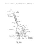 Tissue surface treatment apparatus and method diagram and image