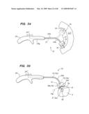 Tissue surface treatment apparatus and method diagram and image