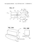 Tissue surface treatment apparatus and method diagram and image