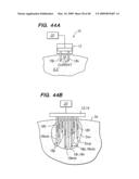 Tissue surface treatment apparatus and method diagram and image