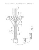 Tissue surface treatment apparatus and method diagram and image