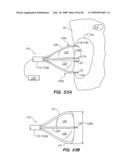 Tissue surface treatment apparatus and method diagram and image