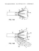 VISUALIZATION AND ABLATION SYSTEM VARIATIONS diagram and image