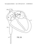 VISUALIZATION AND ABLATION SYSTEM VARIATIONS diagram and image