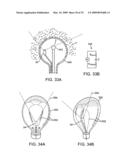 VISUALIZATION AND ABLATION SYSTEM VARIATIONS diagram and image