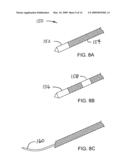 Prostate cancer ablation diagram and image