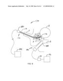 Prostate cancer ablation diagram and image