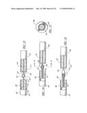 Intracorporeal Occlusive Device And Method diagram and image