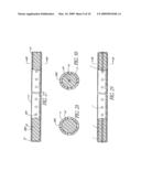 Intracorporeal Occlusive Device And Method diagram and image