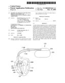 METHOD AND APPARATUS FOR TREATING IRREGULAR VENTRICULAR CONTRACTIONS SUCH AS DURING ATRIAL ARRHYTHMIA diagram and image