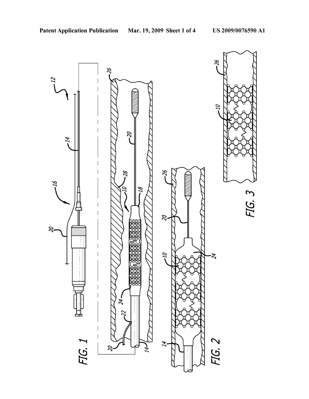 ENDOPROSTHESES WITH STRUT PATTERN HAVING MULTIPLE STRESS RELIEVERS - diagram, schematic, and image 02