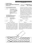 Stent with Protruding Branch Portion for Bifurcated Vessels diagram and image