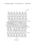 Stent with Protruding Branch Portion for Bifurcated Vessels diagram and image