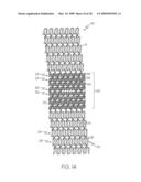 Stent with Protruding Branch Portion for Bifurcated Vessels diagram and image