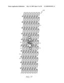 Stent with Protruding Branch Portion for Bifurcated Vessels diagram and image