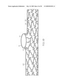 Stent with Protruding Branch Portion for Bifurcated Vessels diagram and image