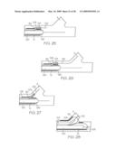 Stent with Protruding Branch Portion for Bifurcated Vessels diagram and image