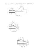 Stent with Protruding Branch Portion for Bifurcated Vessels diagram and image