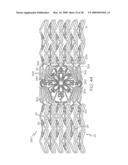 Stent with Protruding Branch Portion for Bifurcated Vessels diagram and image