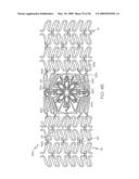 Stent with Protruding Branch Portion for Bifurcated Vessels diagram and image