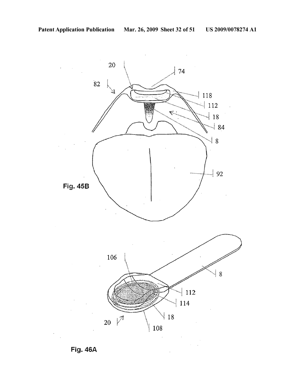 Implantable Obstructive Sleep Apnea Sensor - diagram, schematic, and image 33