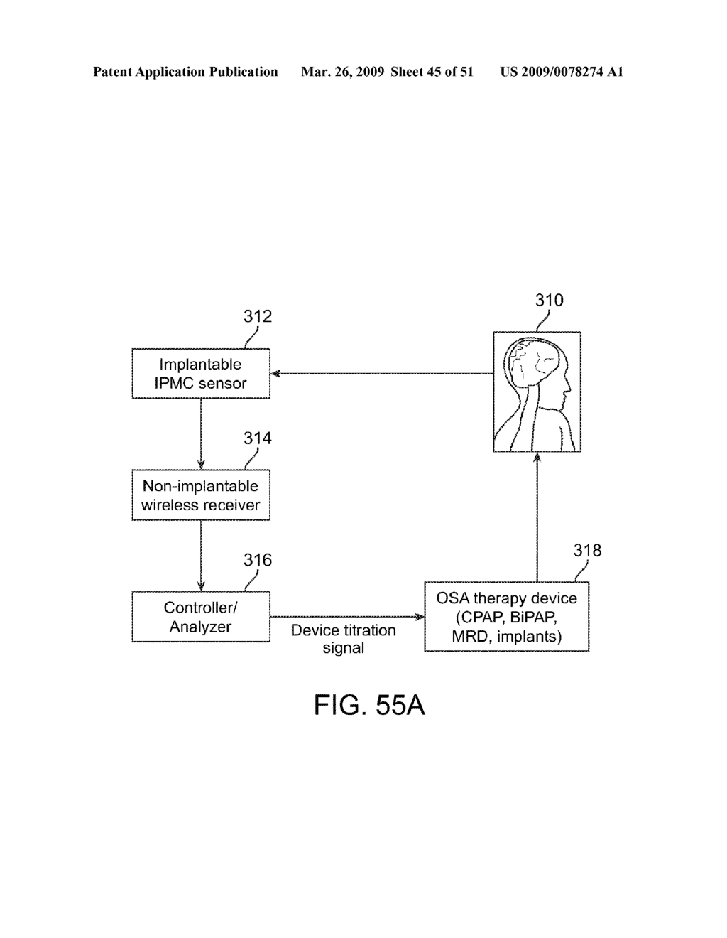 Implantable Obstructive Sleep Apnea Sensor - diagram, schematic, and image 46