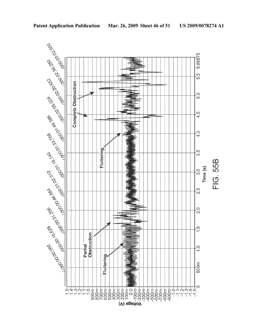 Implantable Obstructive Sleep Apnea Sensor - diagram, schematic, and image 47