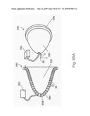 Radioimaging diagram and image