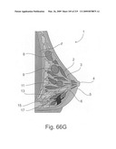 Radioimaging diagram and image