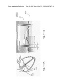 Radioimaging diagram and image