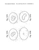 Radioimaging diagram and image