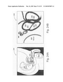 Radioimaging diagram and image