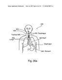 Radioimaging diagram and image