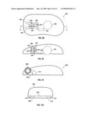 Scrolling Device diagram and image