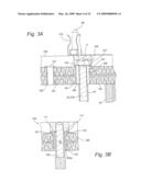 METHOD AND APPARATUS TO SHIELD A NUCLEAR FUEL ASSEMBLY WITH REMOVABLE DEBRIS SHIELD IN UPPER TIE diagram and image