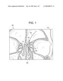 System and Method for Use of Fluoroscope and Computed Tomography Registration for Sinuplasty Navigation diagram and image