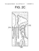 System and Method for Use of Fluoroscope and Computed Tomography Registration for Sinuplasty Navigation diagram and image