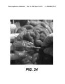 Bioluminescent Endoscopy Methods And Compounds diagram and image