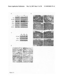 Cardiac progenitor cells diagram and image