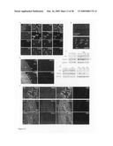 Cardiac progenitor cells diagram and image