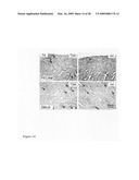 Cardiac progenitor cells diagram and image