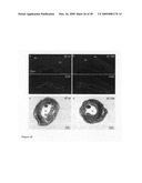 Cardiac progenitor cells diagram and image