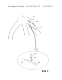 SUSTAINED RELEASE OF APO A-I MIMETIC PEPTIDES AND METHODS OF TREATMENT diagram and image