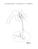 SUSTAINED RELEASE OF APO A-I MIMETIC PEPTIDES AND METHODS OF TREATMENT diagram and image